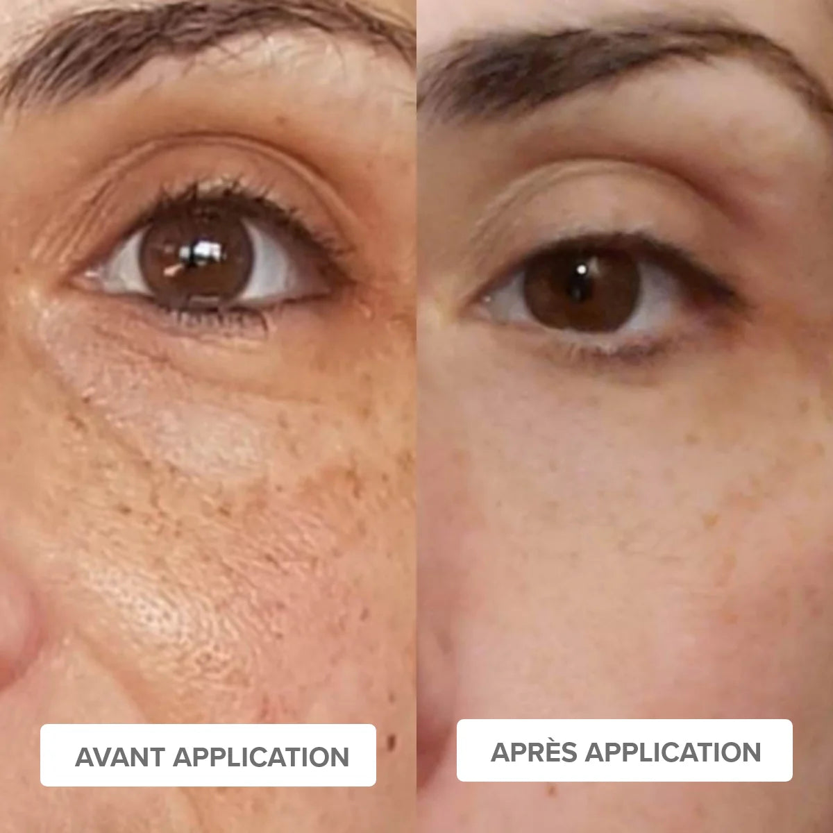 ROUTINE ANTI-TACHES - Eclaircissante & Unifiante - Mademoiselle Agathe